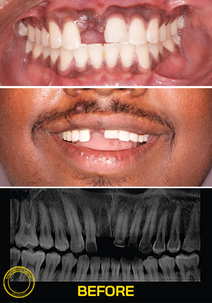 Confydentz dental case reports