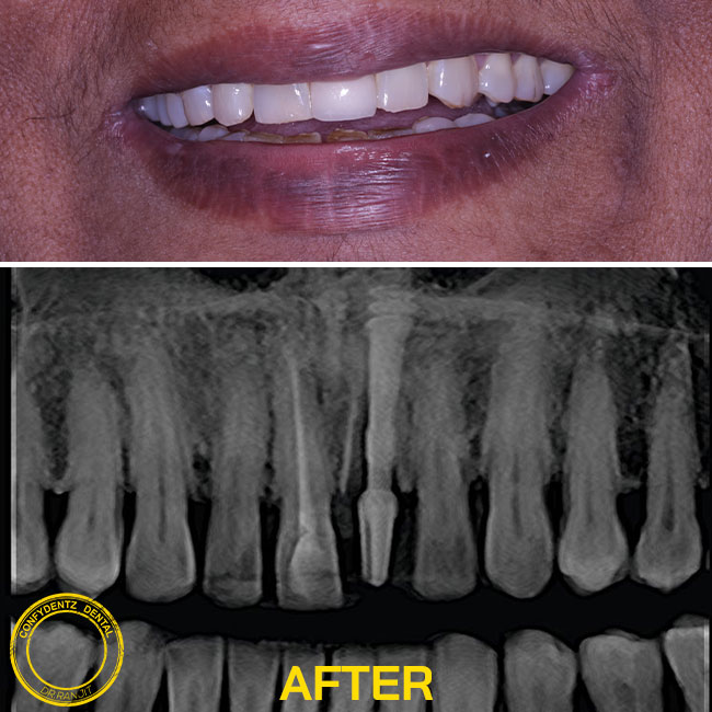 Confydentz dental case reports