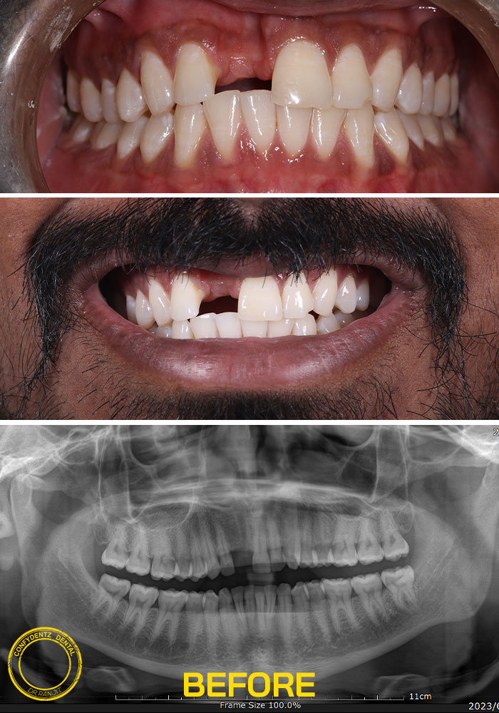 Confydentz dental case reports