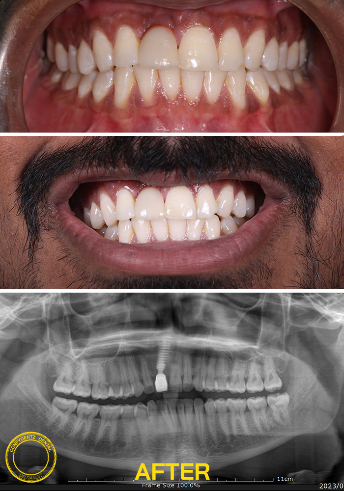 Confydentz dental case reports