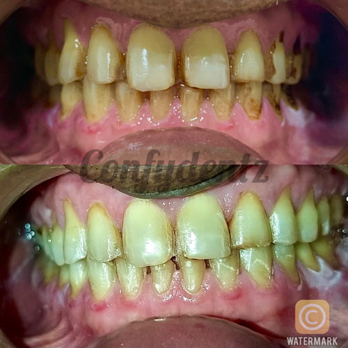 Confydentz dental case reports