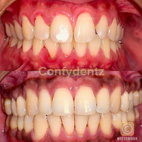 Confydentz dental case reports