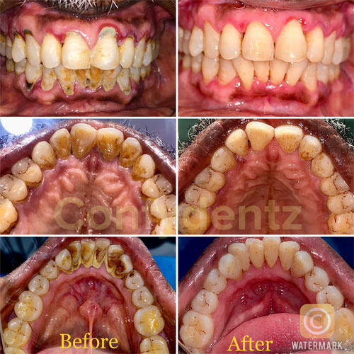 Confydentz dental case reports