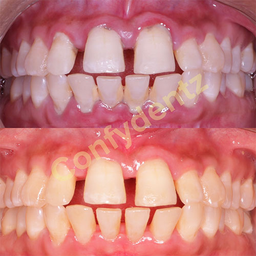 Confydentz dental case reports