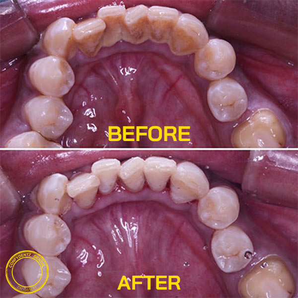 Confydentz dental case reports