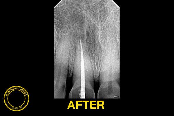 Confydentz dental case reports