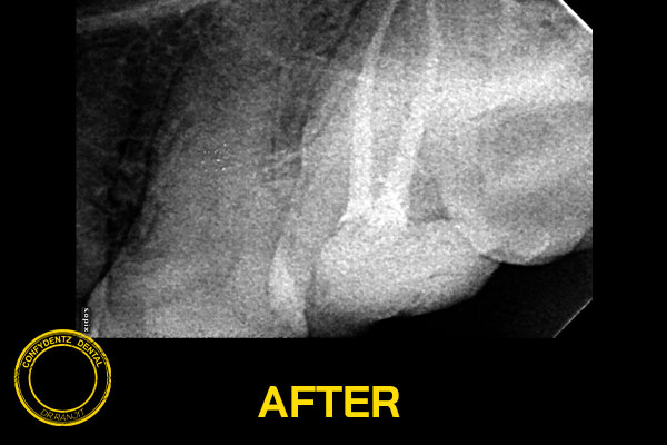 Confydentz dental case reports