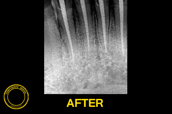 Confydentz dental case reports