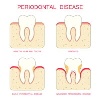 dental disease treatment in AP