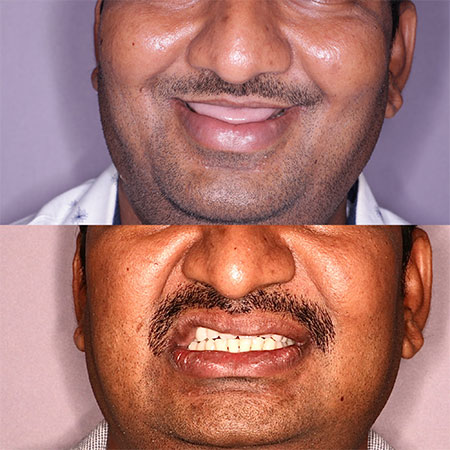 jaw corrective treatment in Guntur