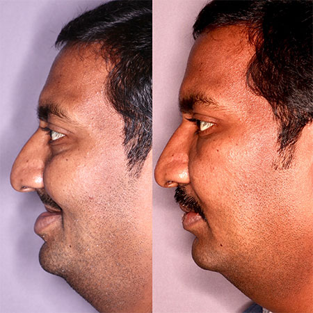 jaw corrective treatment in Guntur