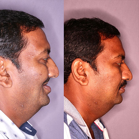 jaw corrective treatment in Guntur