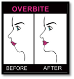 jaw corrective treatment